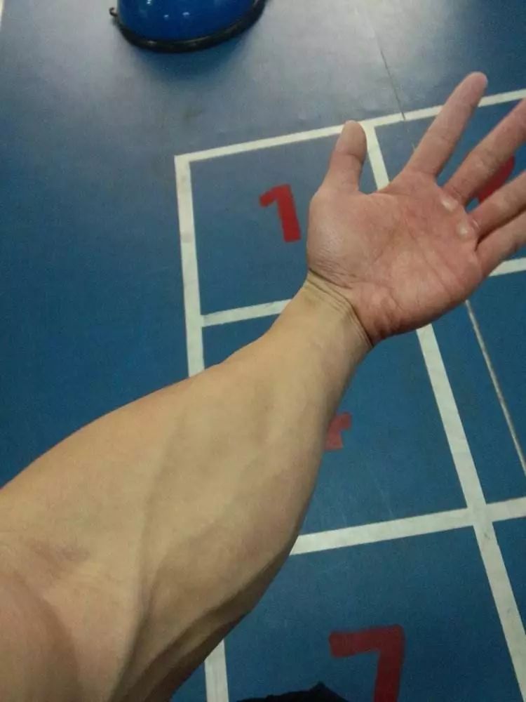 健身手套老茧_手套健身老茧怎么去除_健身手套可以防止老茧吗