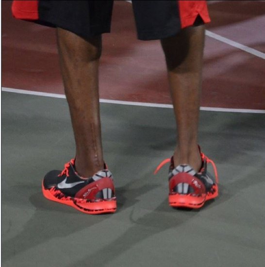 NBA球员跟腱长度_篮球练习弹跳_雷阿伦跟腱长度